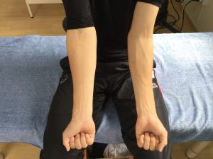 肘が伸びないと感じたら