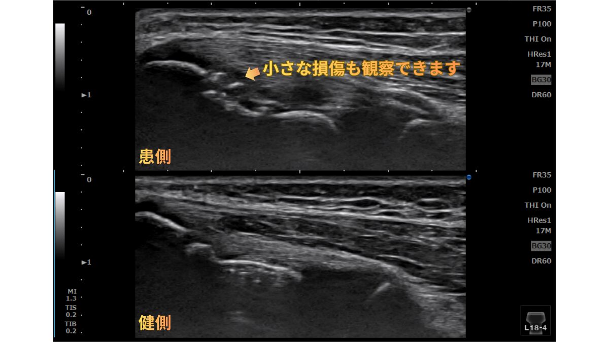 エコー診断画面